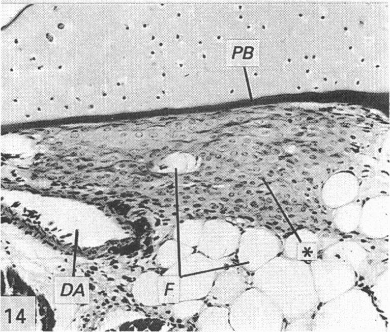 Fig. 14