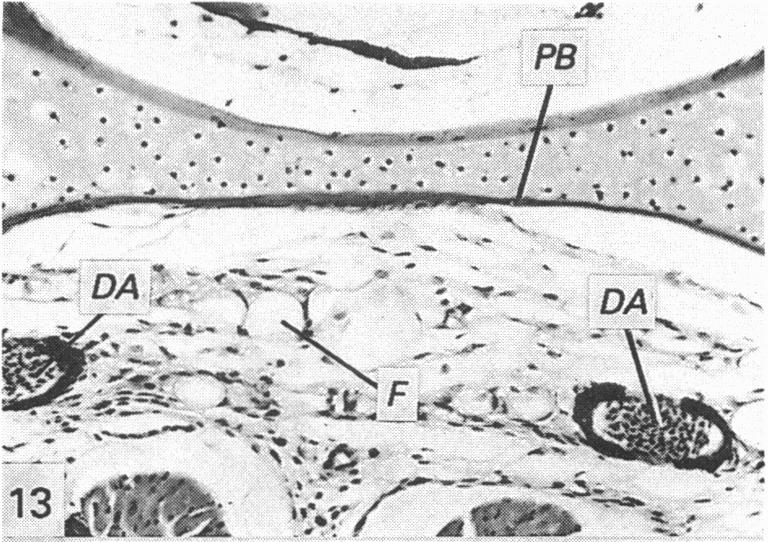 Fig. 13