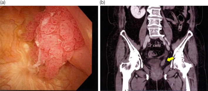 Fig. 1