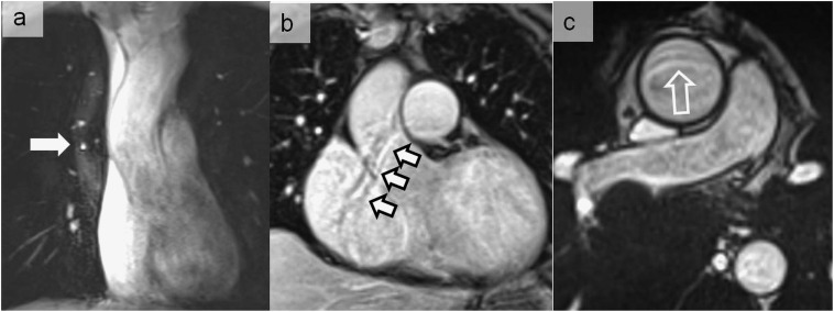 Figure 13.