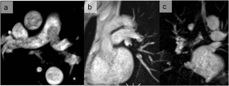 Figure 18.