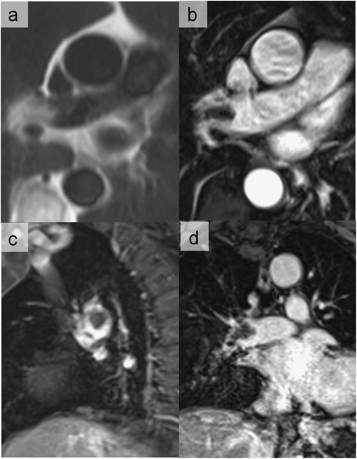 Figure 20.