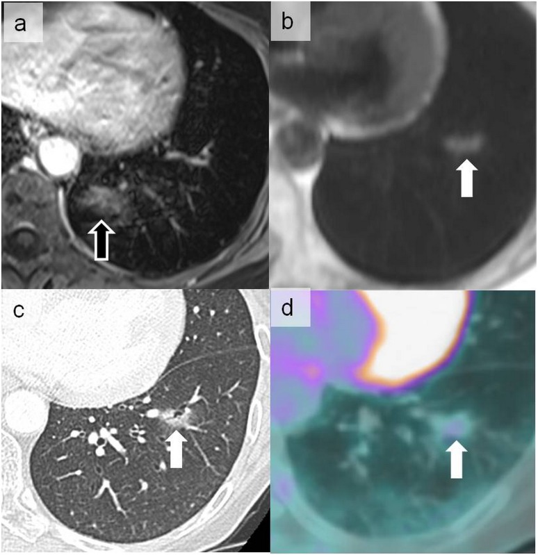 Figure 15.