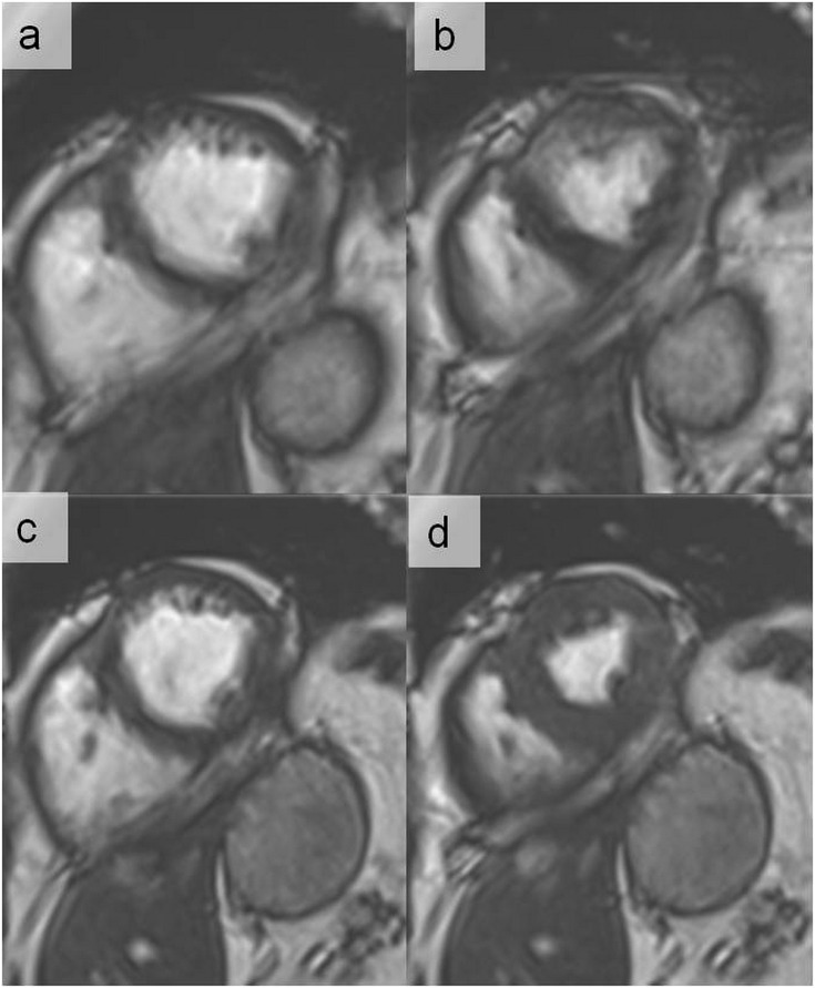 Figure 17.