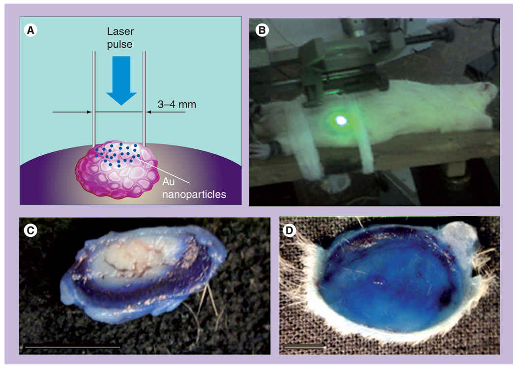 Figure 22