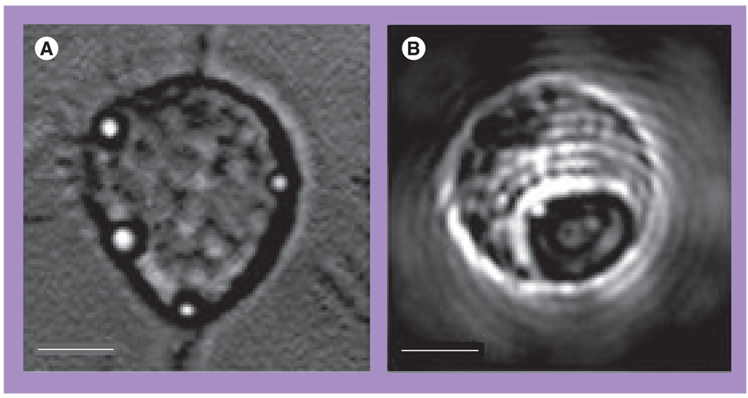 Figure 11