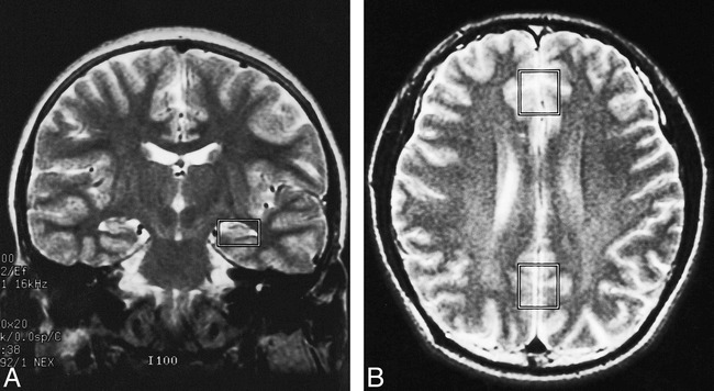 fig 1.