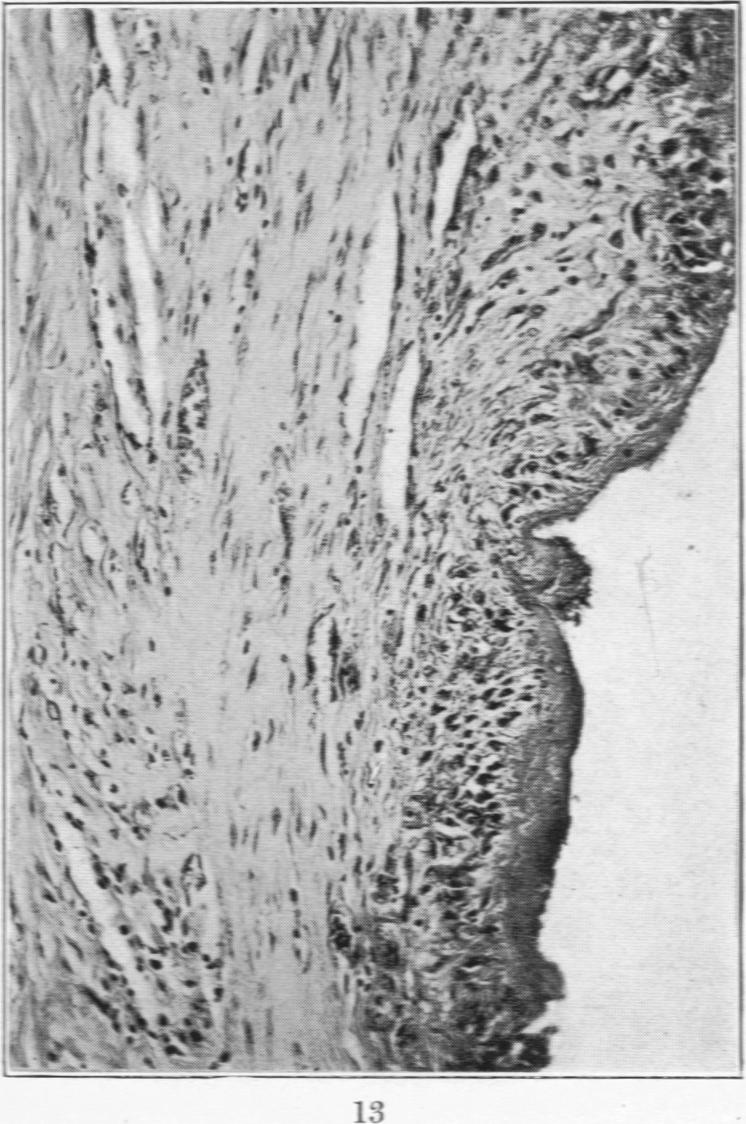 Fig. 13