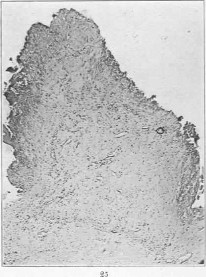 Fig. 25