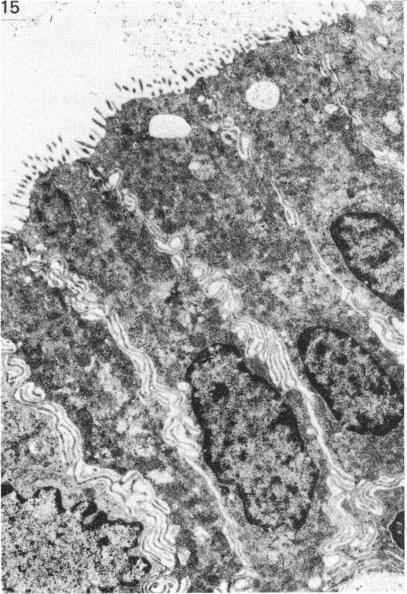 Fig. 15