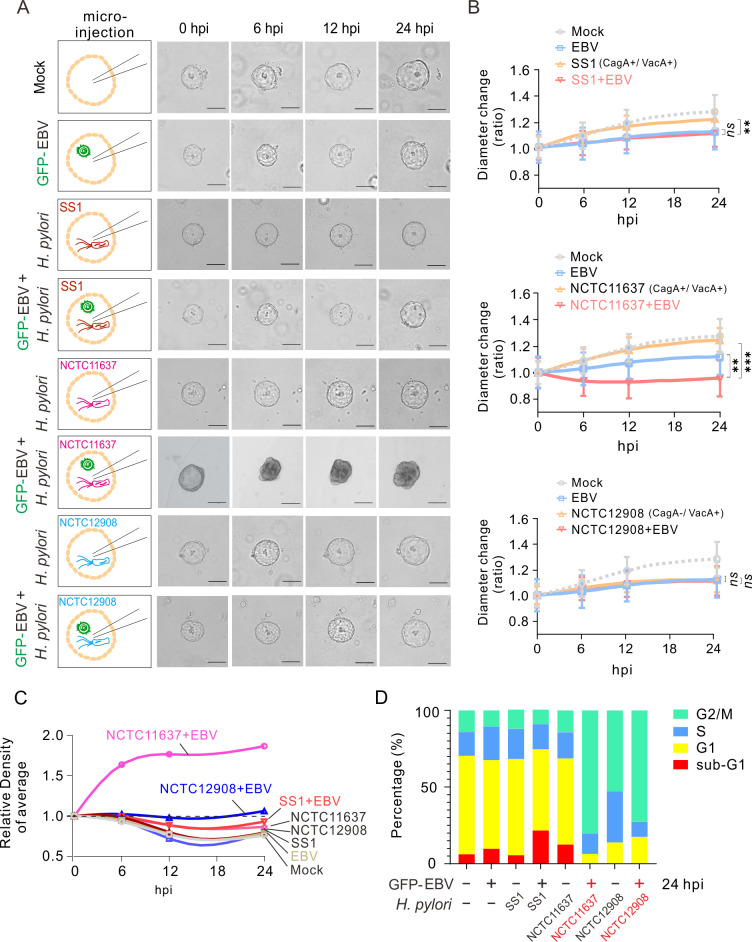 Time-course images of organoids injected with EBV and H. pylori strains; diameter change graphs depict reduced growth with co-infection, relative density increase in NCTC11637 + EBV, and cell cycle analysis indicating sub-G1 population with co-infection.