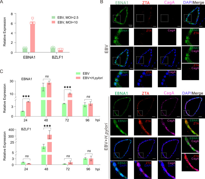 Bar graphs plot EBNA1 and BZLF1 expressions increasing with higher EBV MOI and time. Co-infection with H. pylori enhances EBNA1 at 24 and 72 hpi and BZLF1 at 48 hpi. Confocal images confirm EBNA1 and ZTA localization and co-staining within organoids.