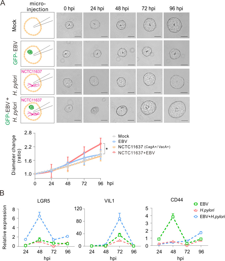 Brightfield images and growth curves plot reduced organoid expansion over 96 h with H. pylori + EBV co-infection. Line plots reveal peak expressions of LGR5, VIL1, and CD44 at 72 hpi in co-infected organoids, indicating epithelial remodeling.