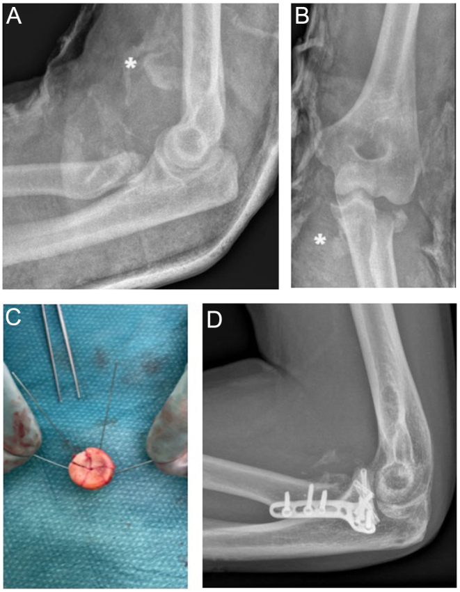 Figure 4