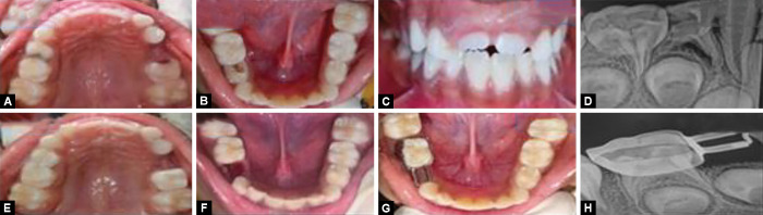 Figs 7A to H: