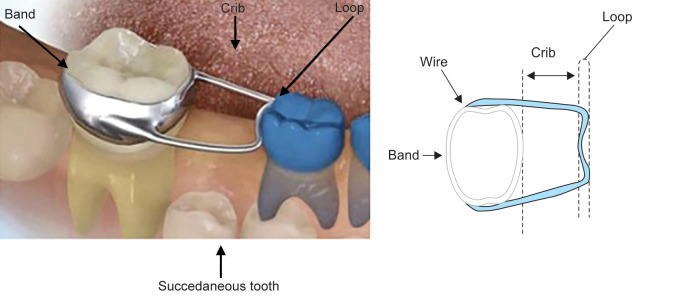 Fig. 1: