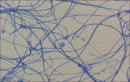Figure-3