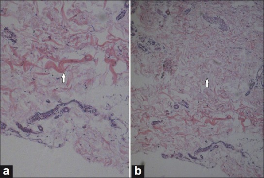 Figure 3 (a, b)