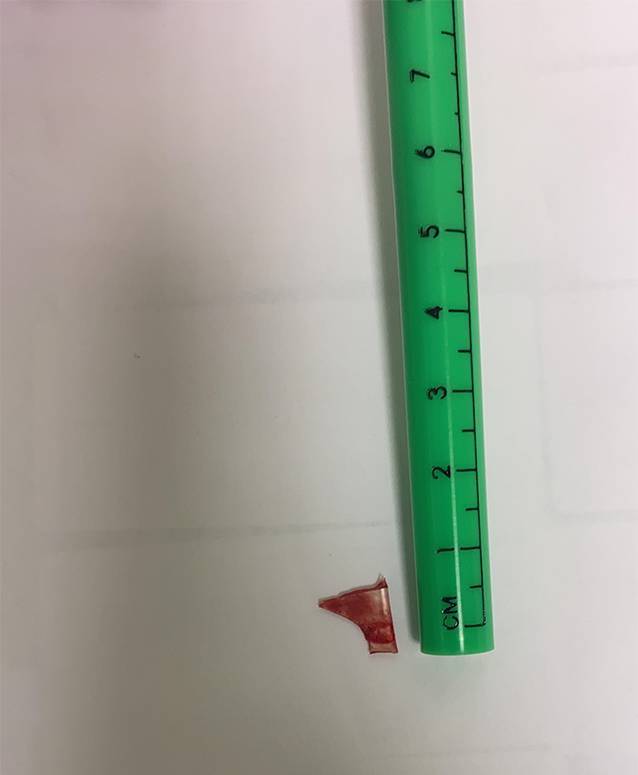 graphic file with name 106_2023_1313_Fig3_HTML.jpg