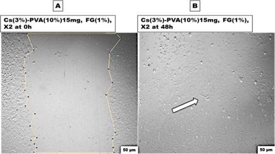 Figure 14