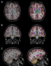 Figure 2: