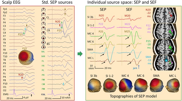 Figure 15