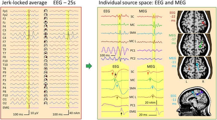 Figure 14