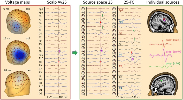 Figure 12