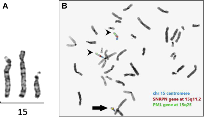 Figure 1