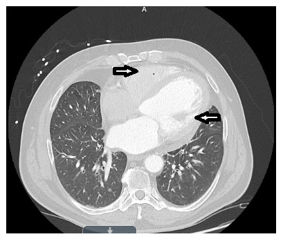 Figure 5. 