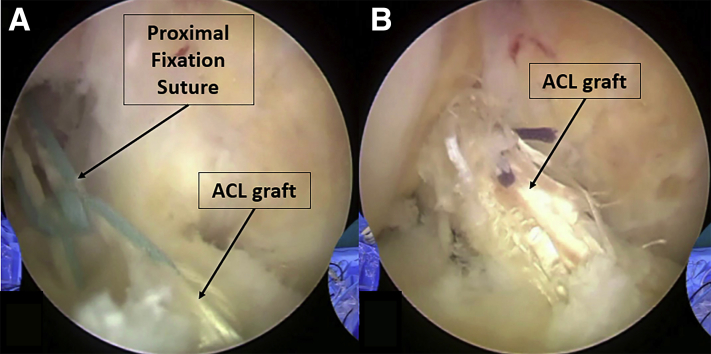 Fig 13