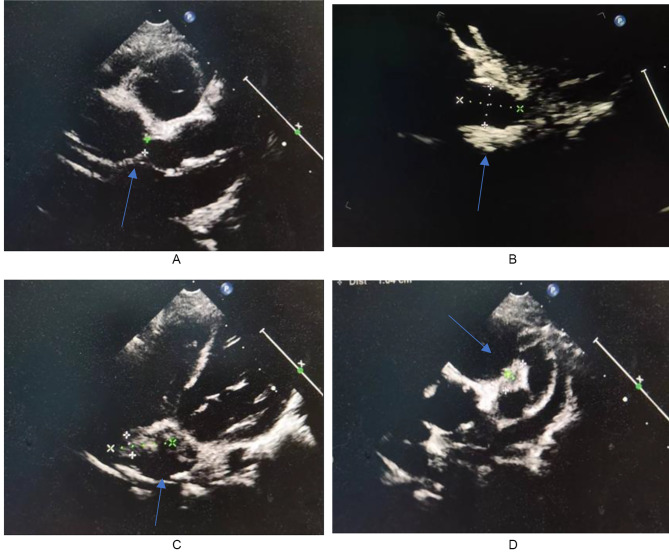 Fig. 2