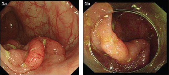 Fig. 1