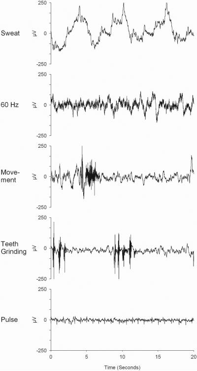 EEG Recording and Analysis for Sleep Research - PMC