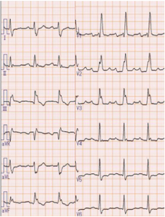 Fig. 1