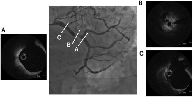 Fig. 3