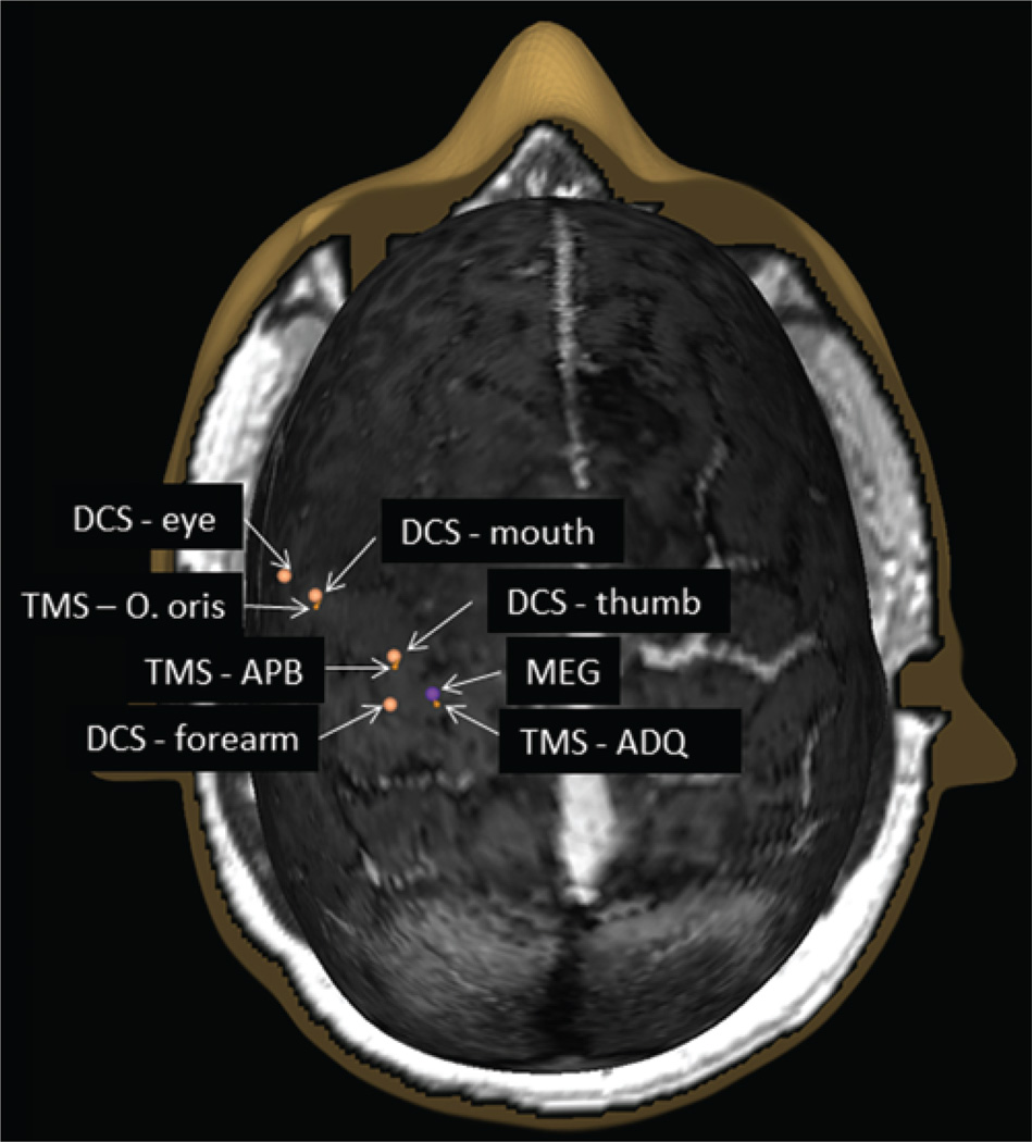 Fig. 3