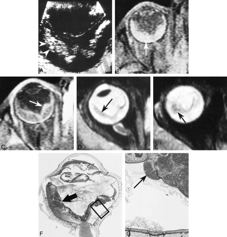 fig 2.