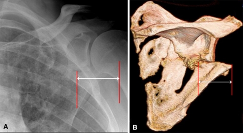 Fig. 1A–B