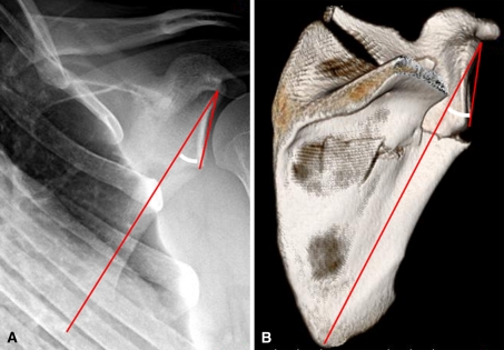 Fig. 4A–B