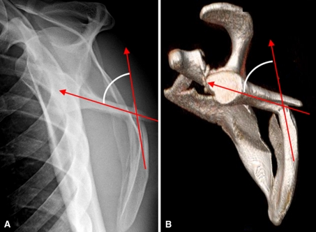 Fig. 3A–B