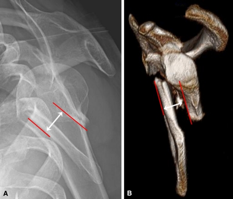 Fig. 2A–B