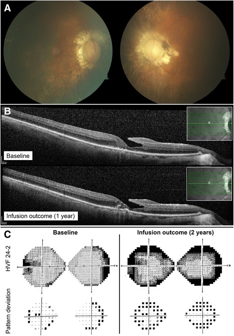 Fig. 4