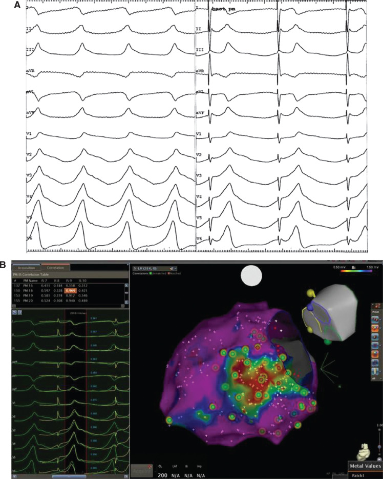 Figure 2: