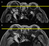 FIG. 4.