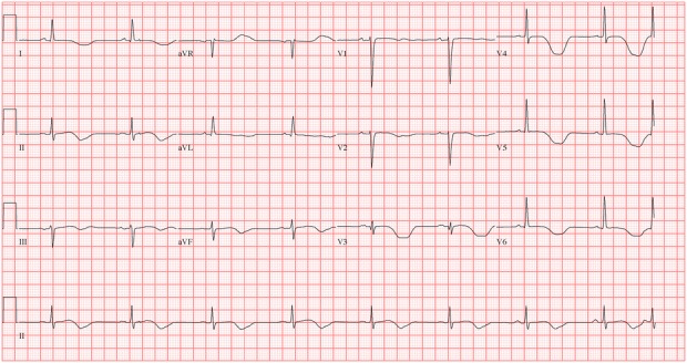 Figure 2