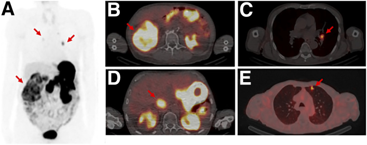 FIGURE 4.
