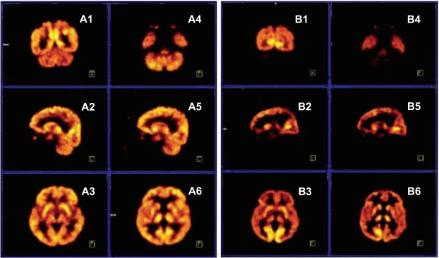 Fig. (4)