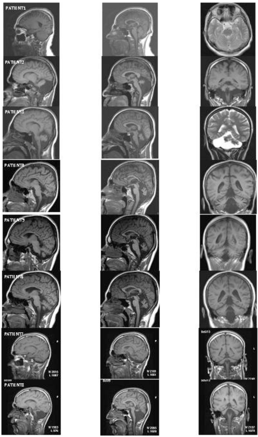 Fig. (3)