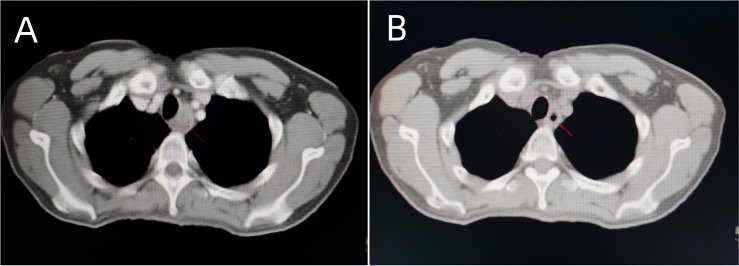 Figure 3